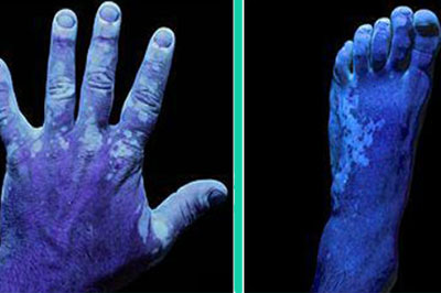Gallery Thumb 2